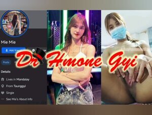 Thumb 1